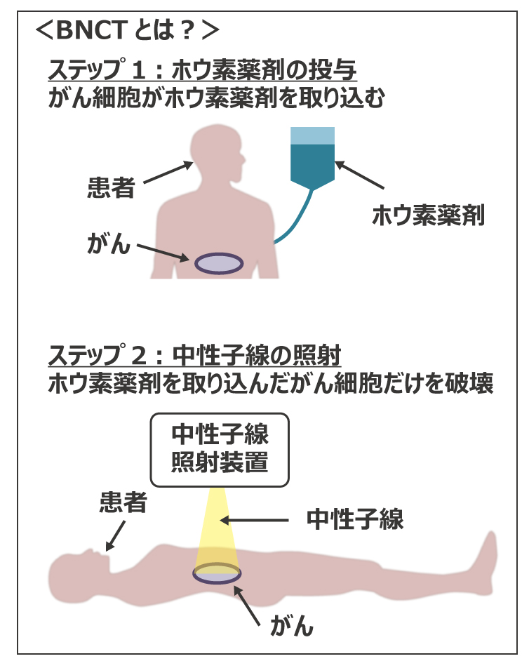 BNCTとは?